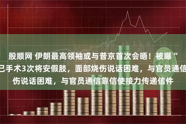 股顺网 伊朗最高领袖或与普京首次会晤！被曝“身负重伤”：一条腿已手术3次将安假肢，面部烧伤说话困难，与官员通信靠信使接力传递信件